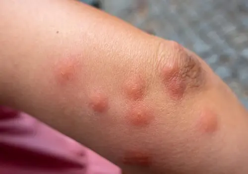 【網購傢俬注意】淘寶傢俬送床蝨!? 滅蟲專家：9成淘寶木傢俬有蝨蟲! 拆解6大成因＋防蝨步驟 illustrative image